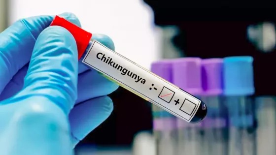 Confirman en Tartagal el segundo caso de Chikungunya con antecedente de viaje a Bolivia