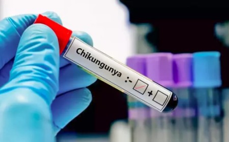 Confirman en Tartagal el segundo caso de Chikungunya con antecedente de viaje a Bolivia