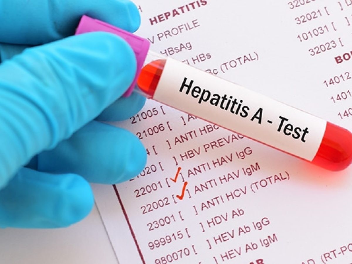 Hepatitis A en Salta: Ya son 13 casos y San Martín concentra más de la mitad