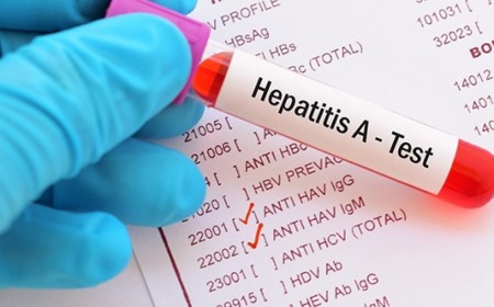 Hepatitis A en Salta: Ya son 13 casos y San Martín concentra más de la mitad